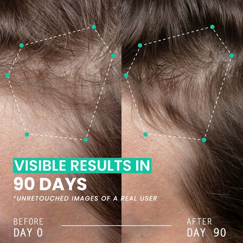 Hair Thickening Dual Action Routine - 90 Day Anti Hair Loss Solution image number null