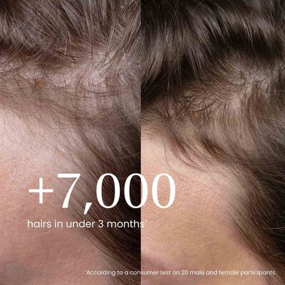 Densify Strengthening Hair Ampoules hover view