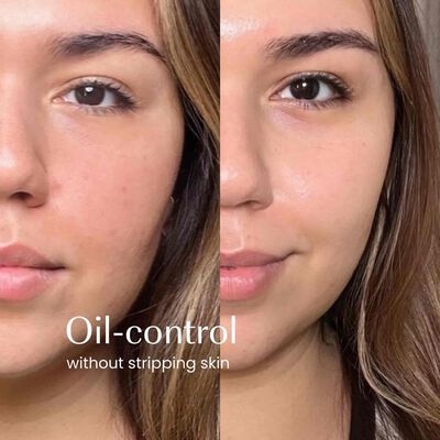 Green Tea Oil-Control Gel Cleanser hover view